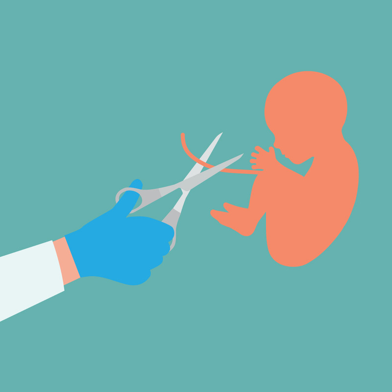 Cartoon Style Cutting Umbilical Cord Illustration - Features Image 1