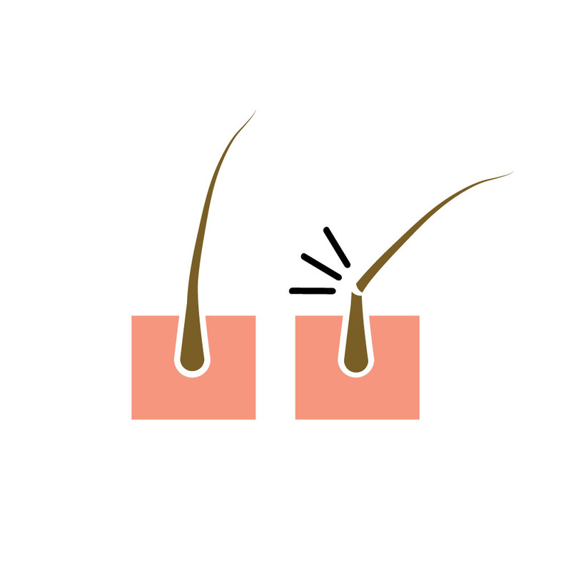 Haarausfall Vektor Symbol Symbol isoliert Abbildung - Eigenschaften Bild 1