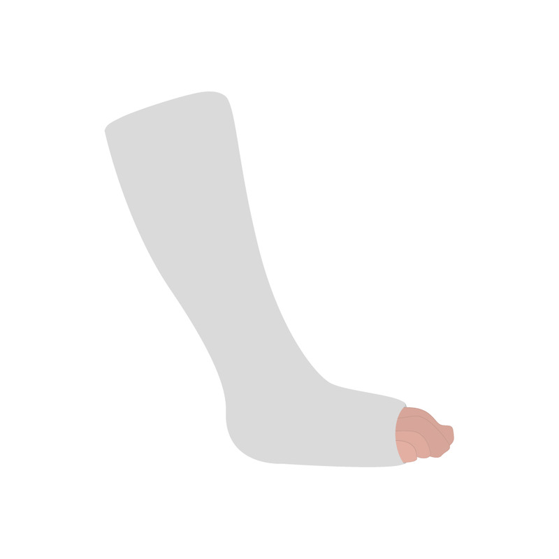 Detailed Broken Leg with Plaster Cast Medical Vector Illustration - Features Image 1