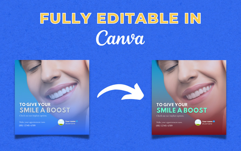 70 Premium Dentist Canva Templates For Social Media - Features Image 2